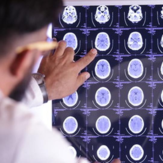 A man wearing glasses with dark hair and beard has his back to the camera and is looking at multiple scan images of a human brain and pointing with his finger at one of the images. 