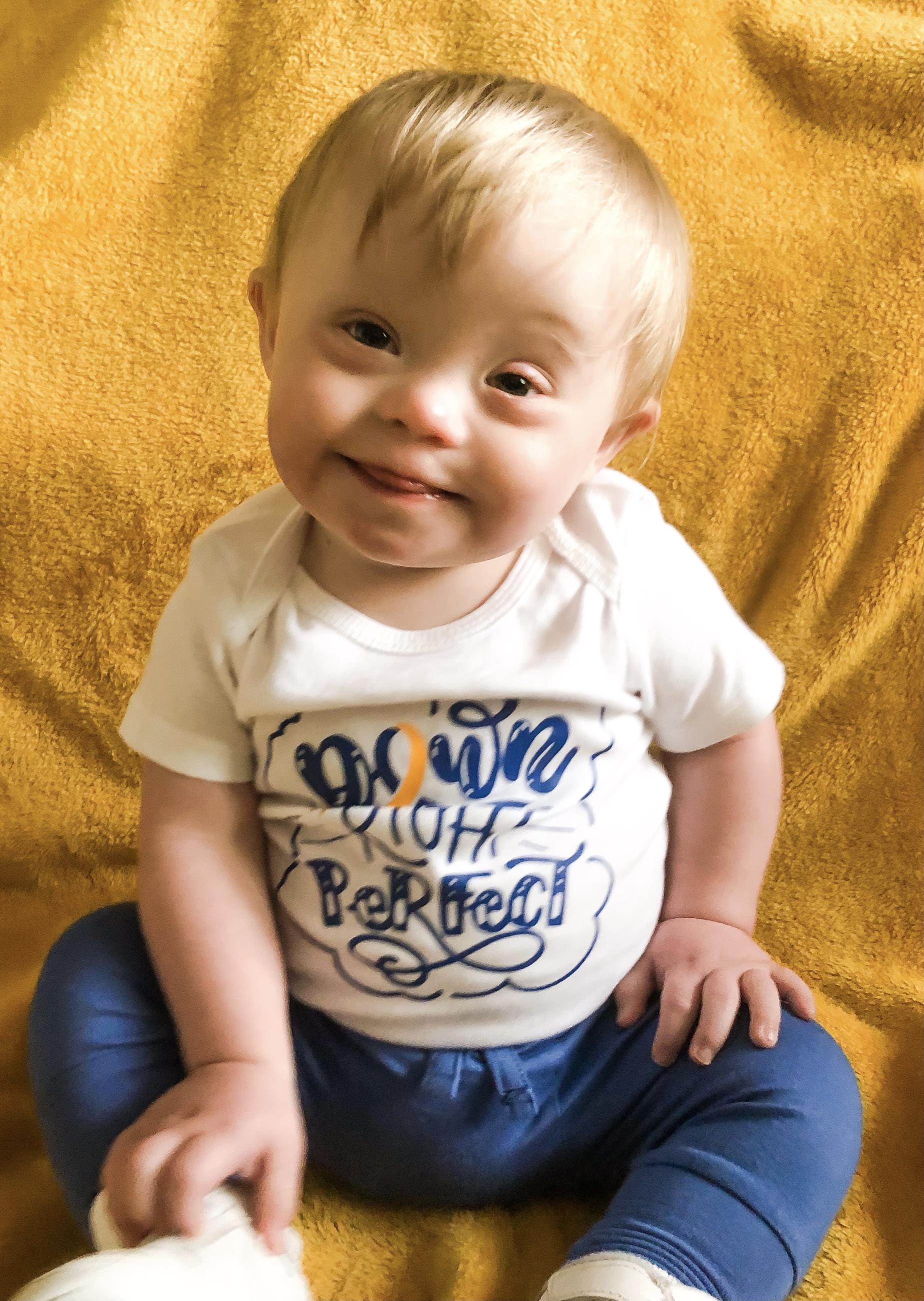 Baby with Down Syndrome
